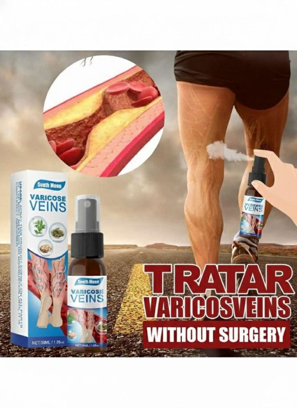 Spray Adiós Venas para Varices y Arañitas | Alivio de Piernas Pesadas, Refrescante y de Absorción Rápida