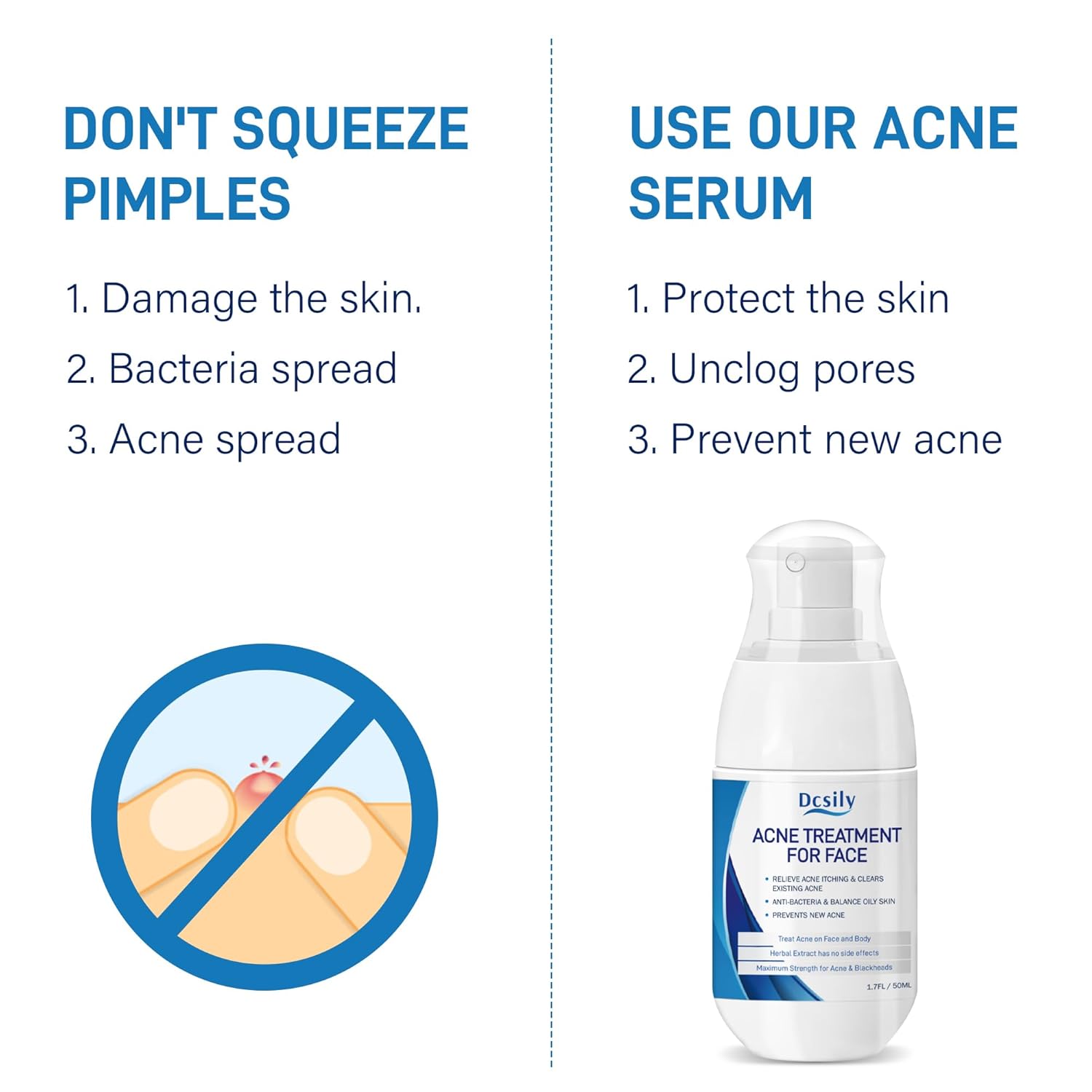 DCsily Acne Treatment for face