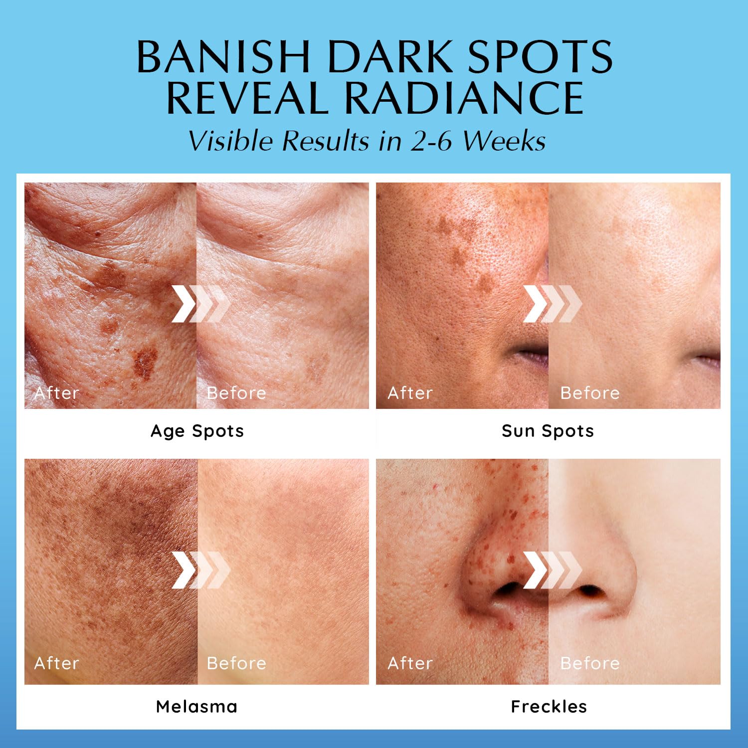 Enaskin Dark Spot Remover-50ml