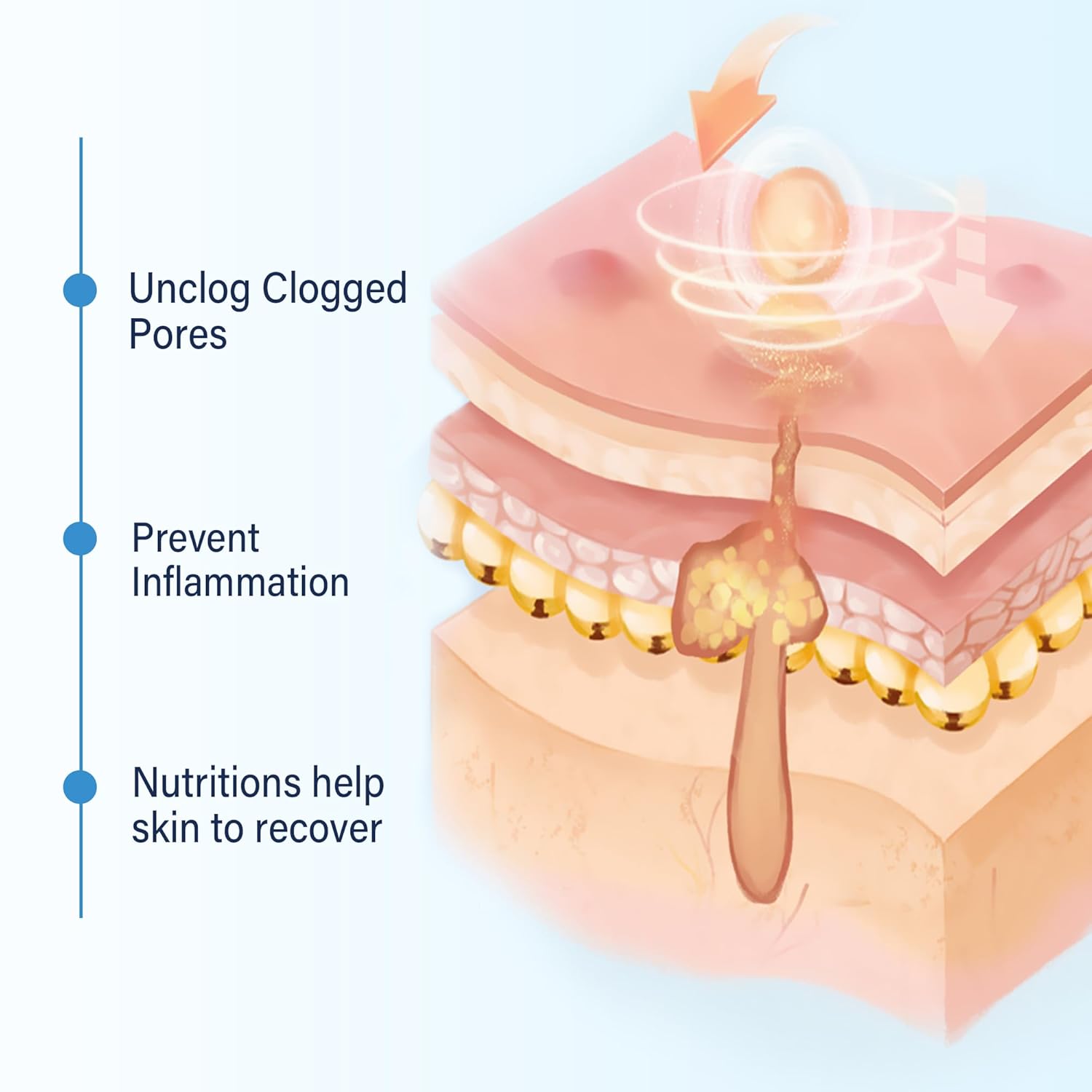 DCsily Acne Treatment for face