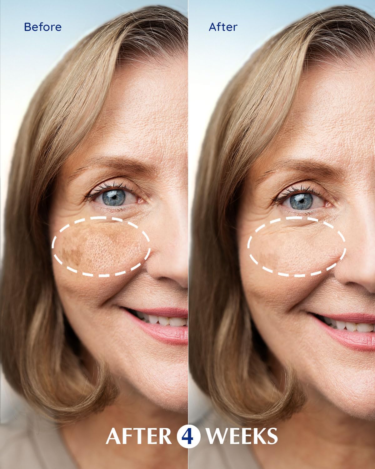 Enaskin Dark Spot Remover Serum-15ml