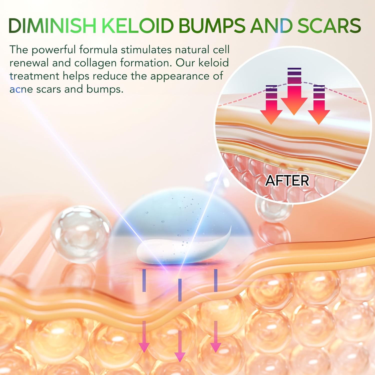 Tobcharm Keloid Bump Removal -30g
