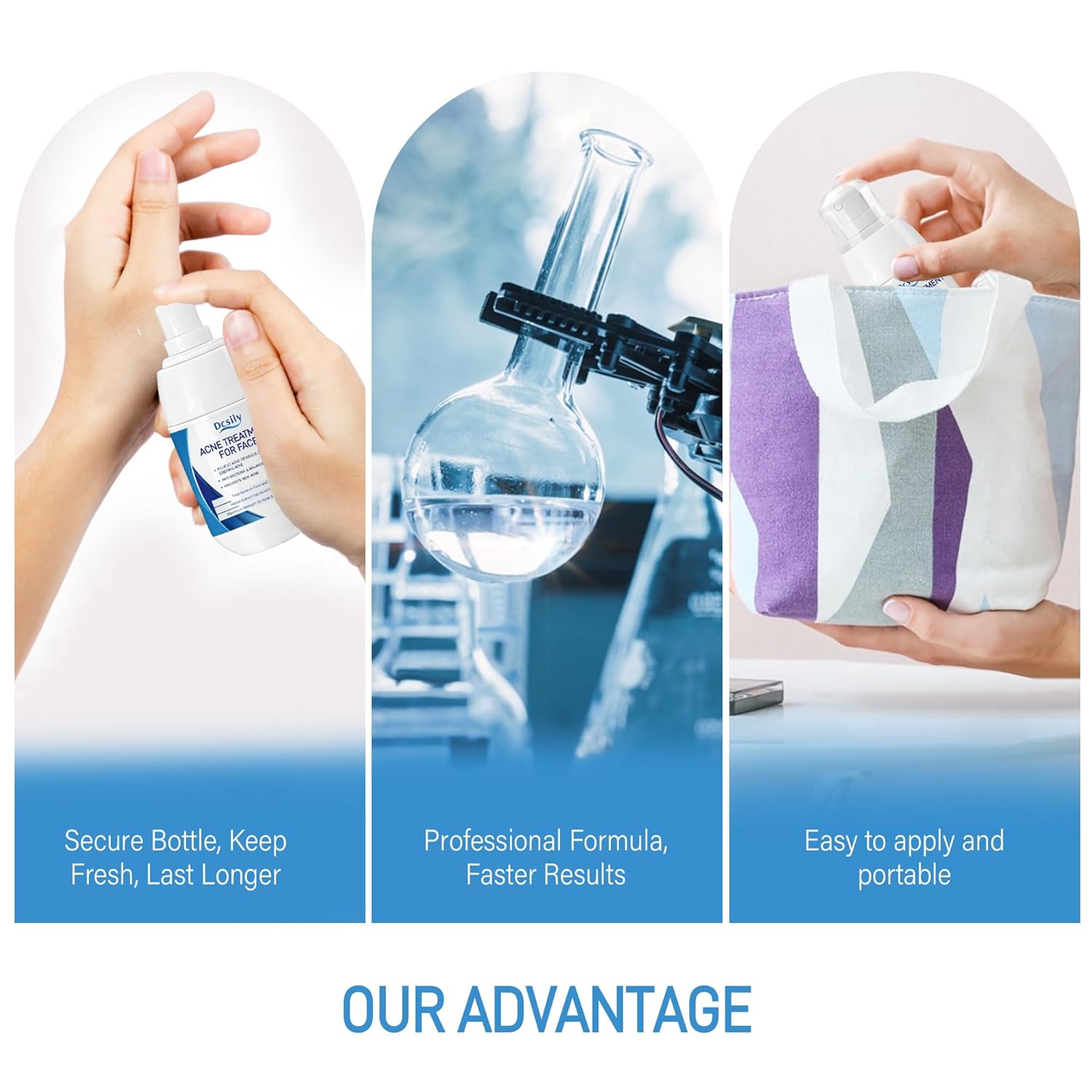 DCsily Acne Treatment for face