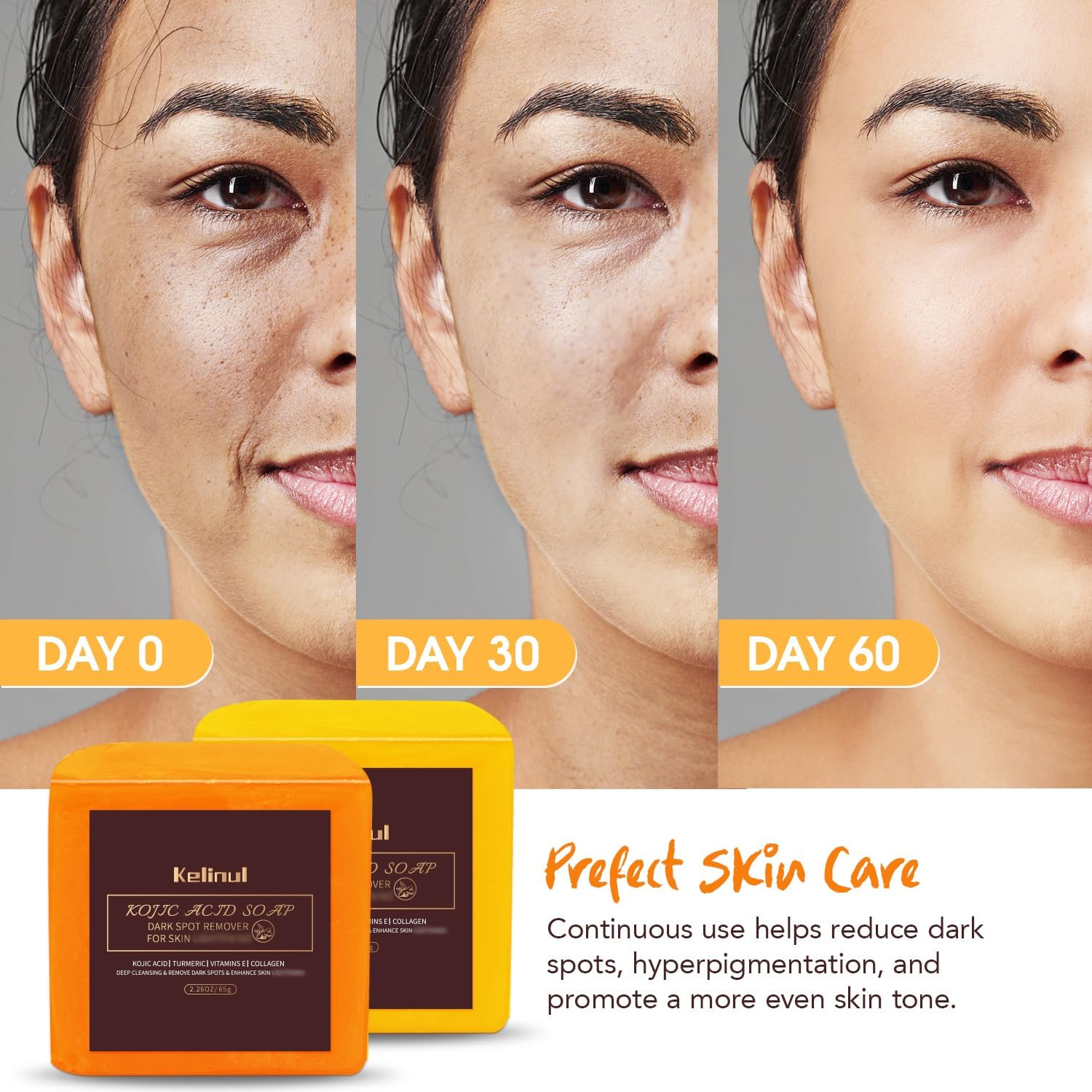 Kelinul Kojic Acid Soap