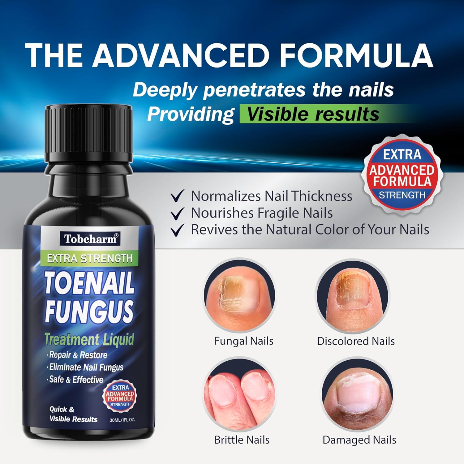 Tobcharm Nail Fungus Treatment - 30ml