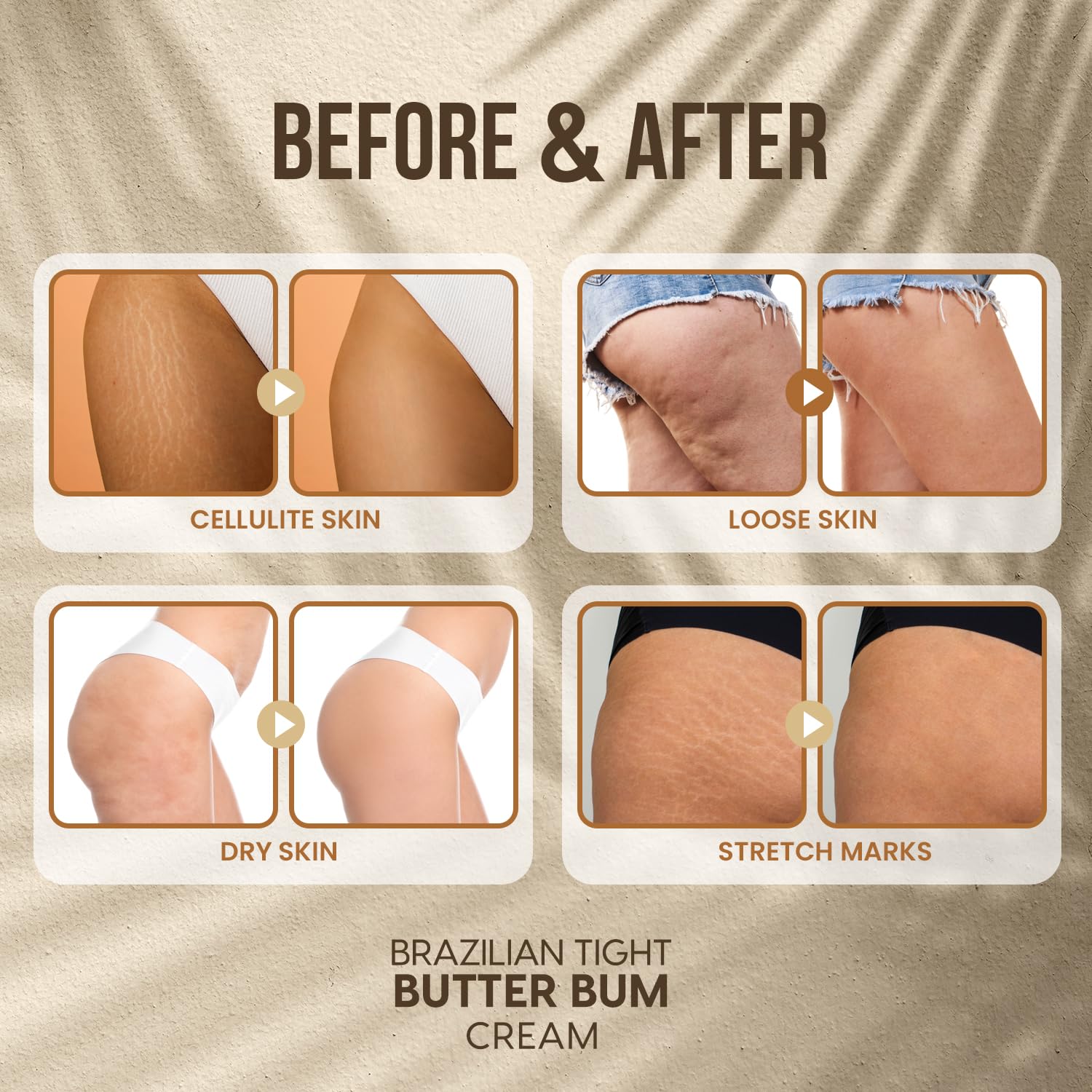 ALAKAZIA Bum Bum Cream - 100ml