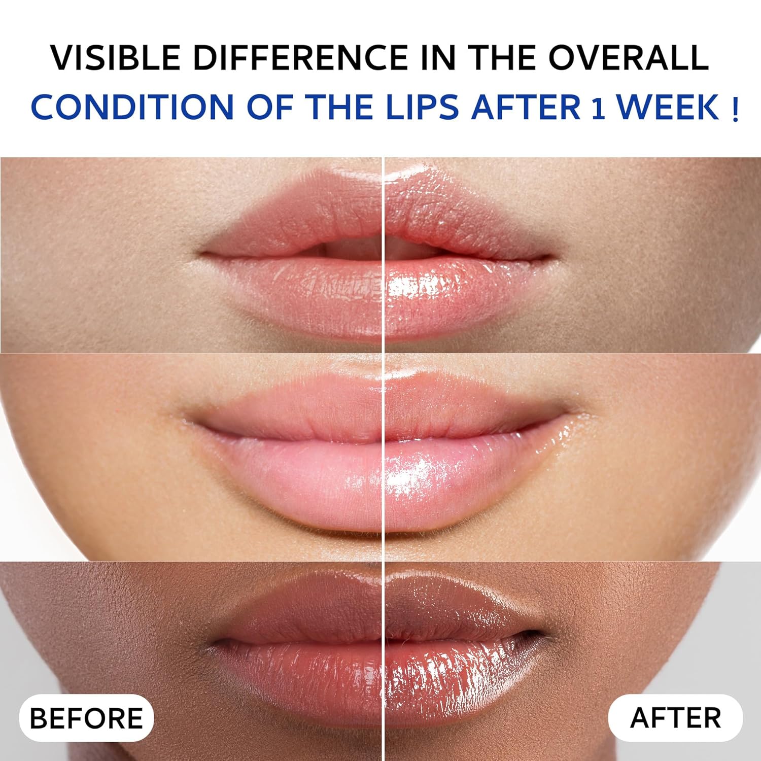 TOBCHARM Lip Collagen -20g