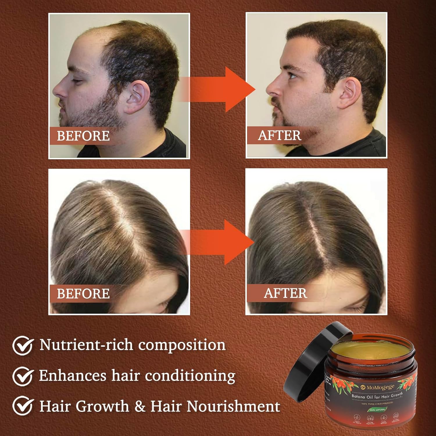 Organic Batana Oil For Hair Growth  4.2 OZ