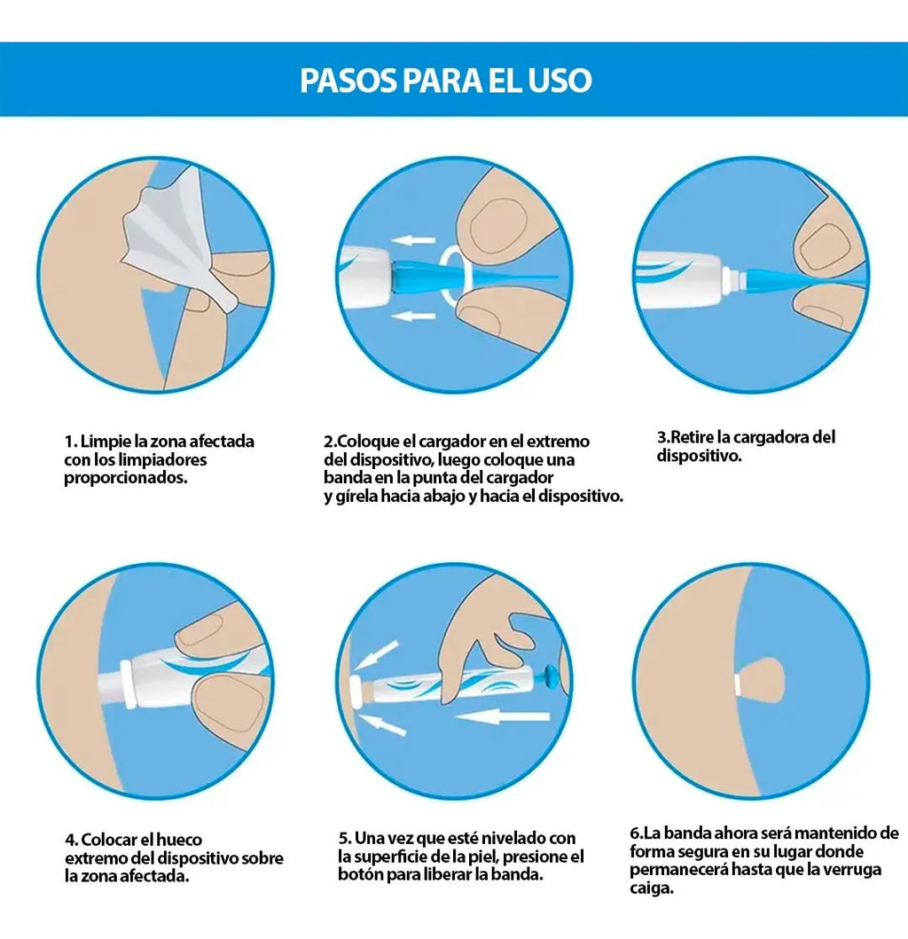 Kelinul Auto Skin Tag Remover Kit (2-in-1)