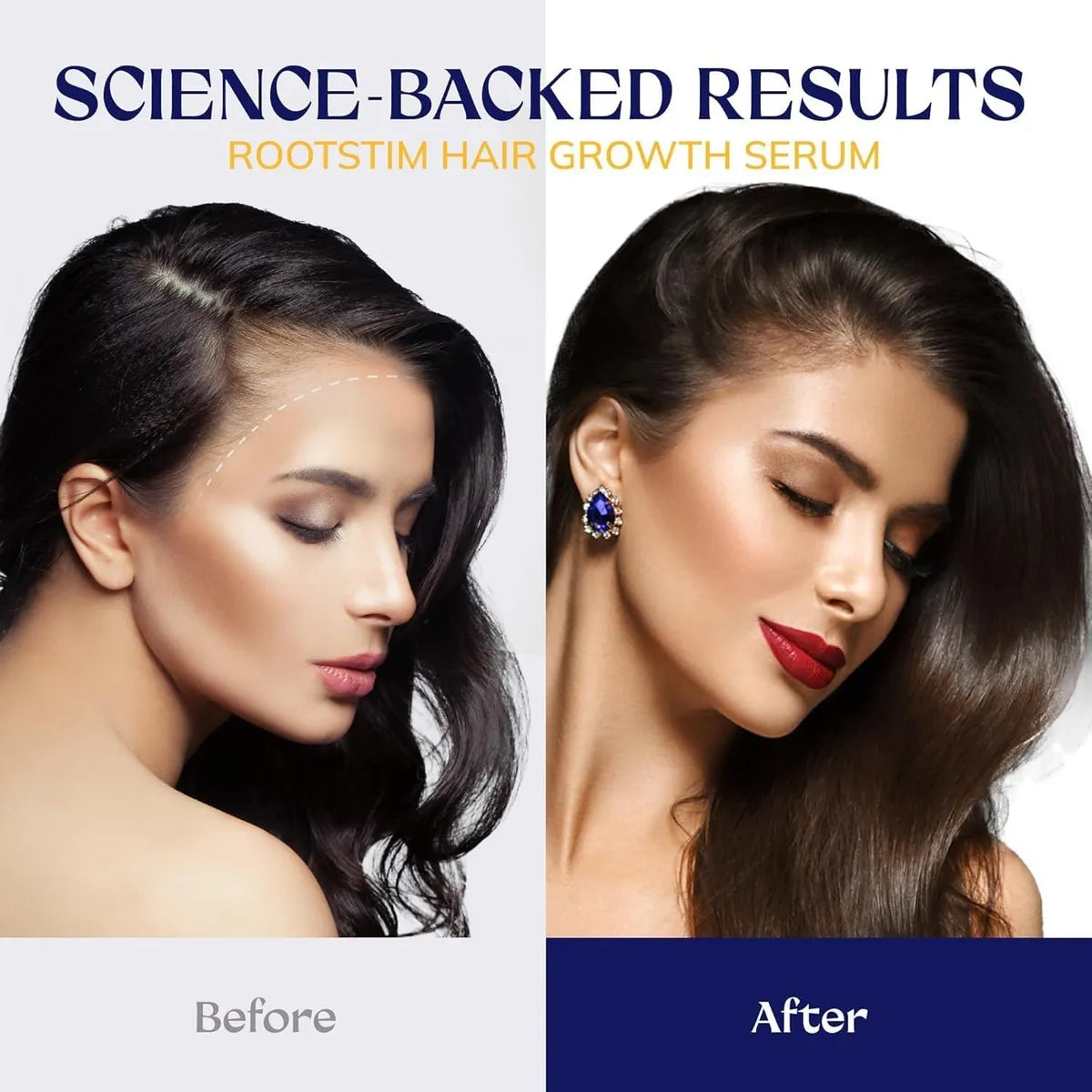 RootStim Hair Growth Serum-60ml