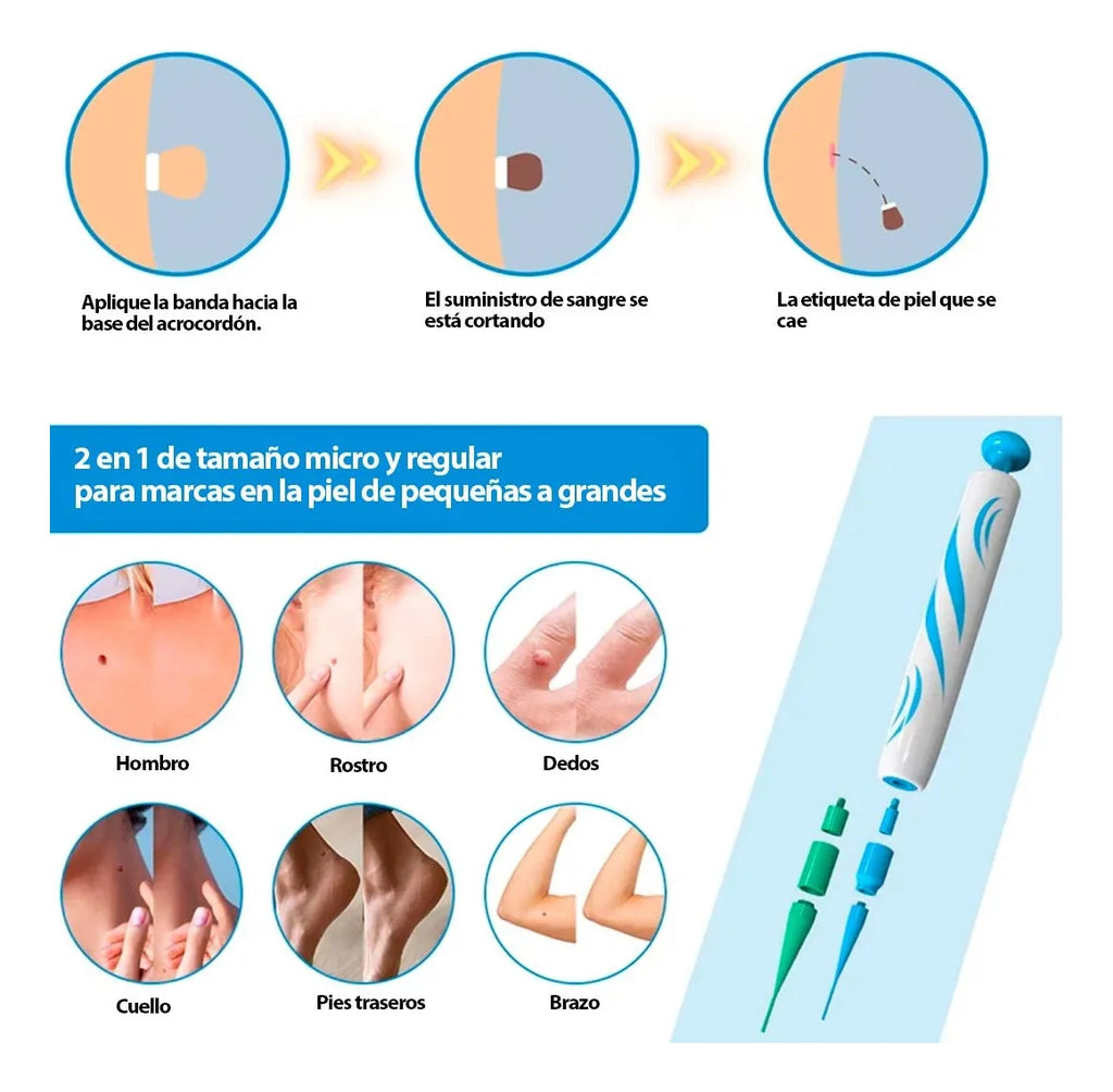 Kelinul Auto Skin Tag Remover Kit (2-in-1)