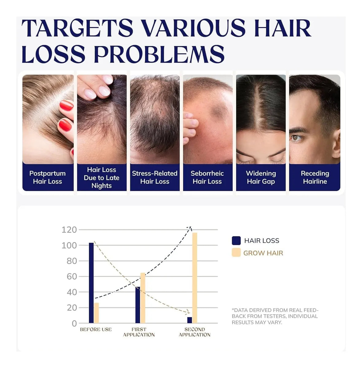 RootStim Hair Growth Serum-60ml