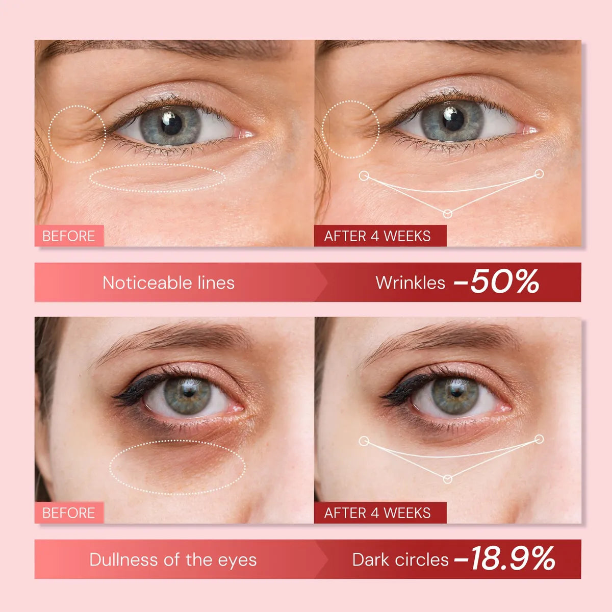 Enaskin Naturals Retinol Eye Cream-25g