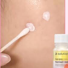 A Solution Eoseongcho Calamine Calming Spot 10 ml